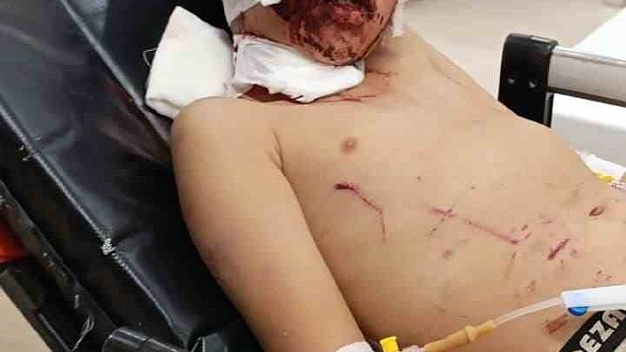 Erzurum''da küçük çocuğa köpekler saldırdı
