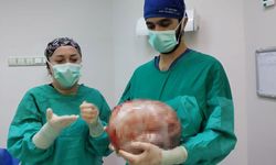 Karnı 2 ayda 9 aylık hamile gibi büyüyen kadının içinden karpuz kadar kitle çıkarıldı