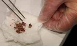 Burundan taş çıktı