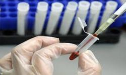 PUANA DAYALI SONUÇ KARŞILIĞI GAİTA TESTİNE AİT TİBBİ CİHAZ HİZMET ALIM İHALESİ