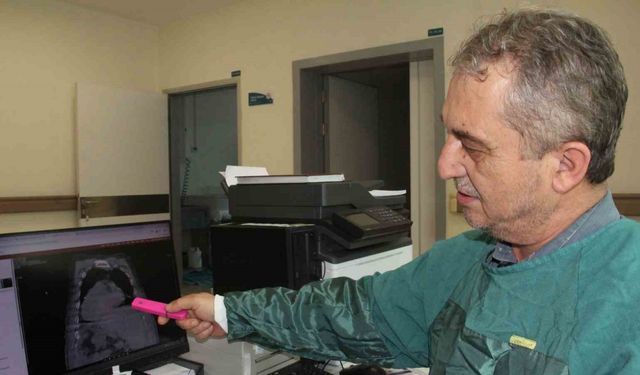 "Karadeniz PEG Kuralı"