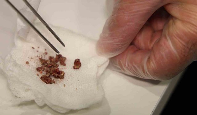 Burundan taş çıktı