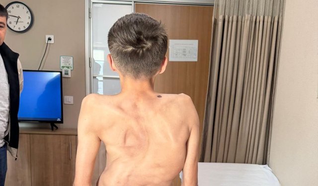 Kırgızistanlı genç şifayı Türk hekimlerinde buldu