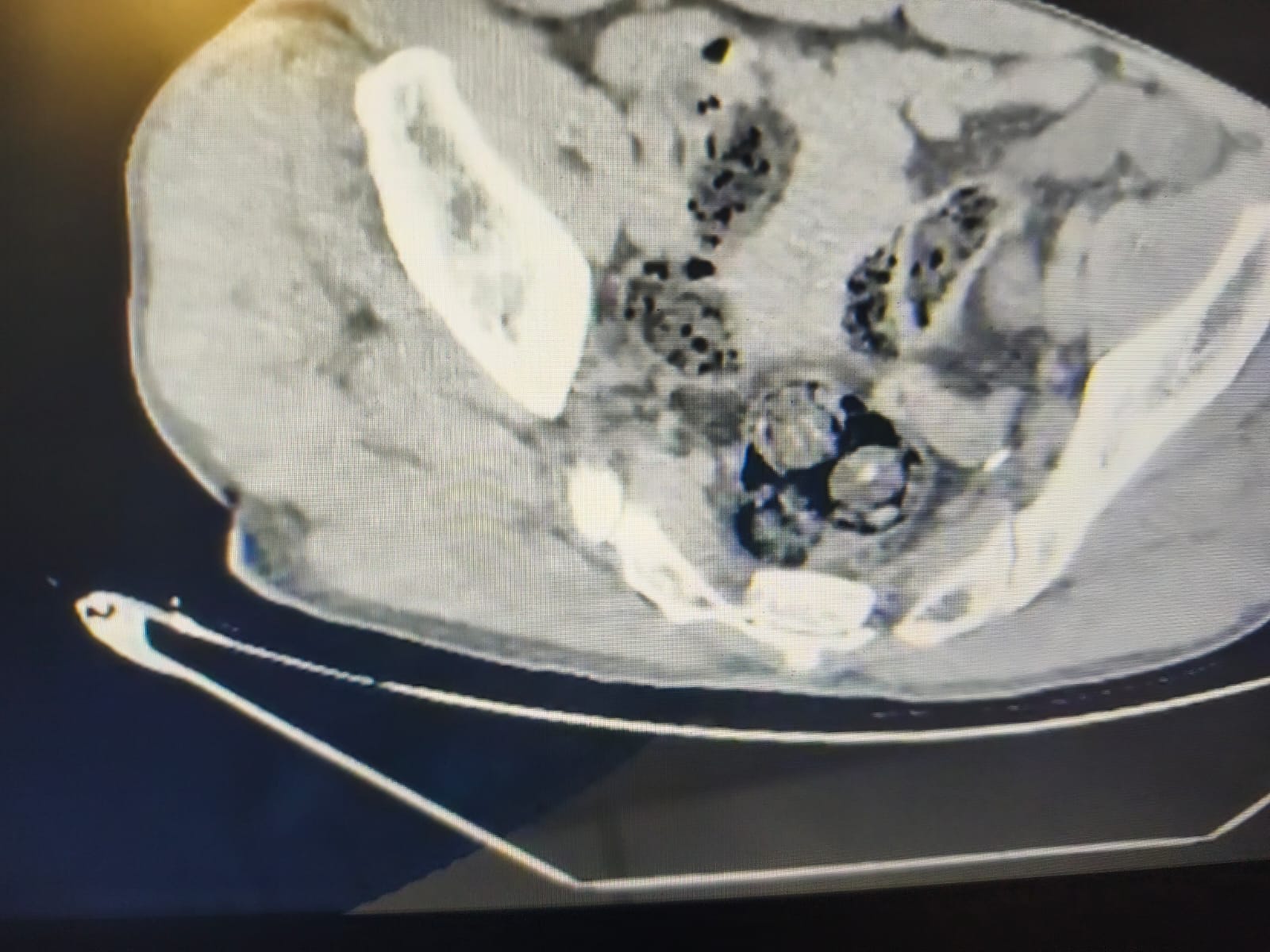 0303D772 Eb64 4A03 8E75 4170E796Eb03